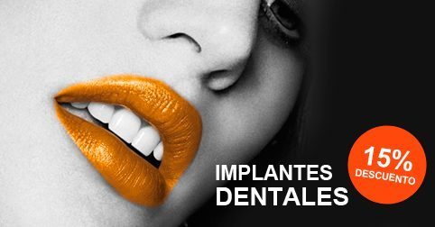 Descuento implantes dentales
