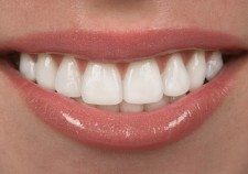 clínica dental Carmona