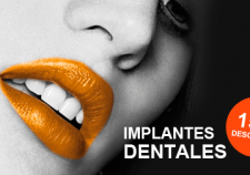 Descuento implantes dentales